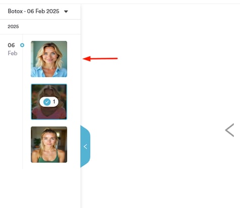 How to Compare Before and After Photos in the Client Card_13