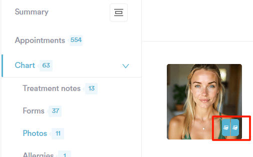 How to Compare Before and After Photos in the Client Card_15