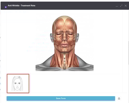 How to Mark Injection Points in a Treatment Note_5