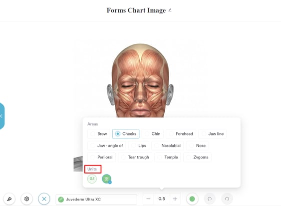 How to Mark Injection Points in a Treatment Note_7