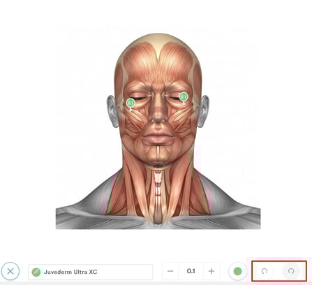 How to Mark Injection Points in a Treatment Note_8