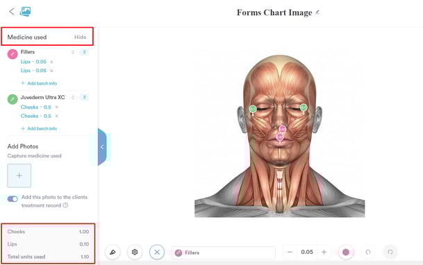 How to Mark Injection Points in a Treatment Note_9