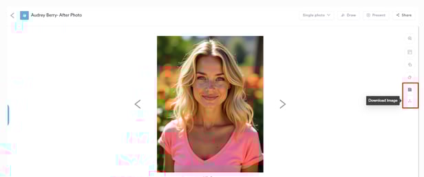 How to Rotate Photos in the Client Card_5