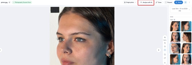 analyze-with-ai-opened-phot