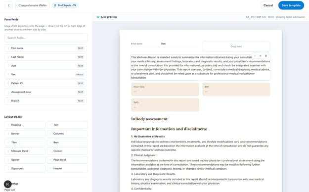 Custom print template designer — form fields, layout blocks and live preview