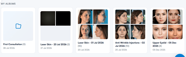 My albums section at the top of the Albums view