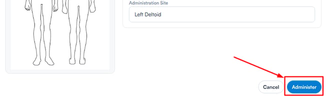 Administer button in the bottom right corner of the modal