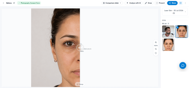 Comparison slider view with the photo sidebar on the right