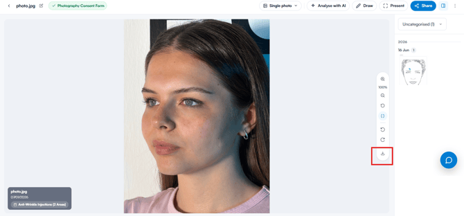 Tool rail on the right-hand edge of the photo viewer with the download control