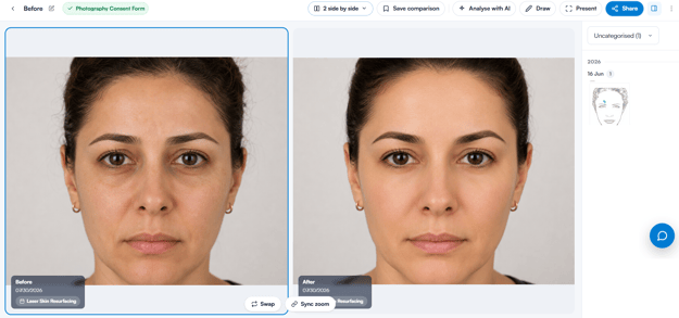 Photo comparison view in the new client card