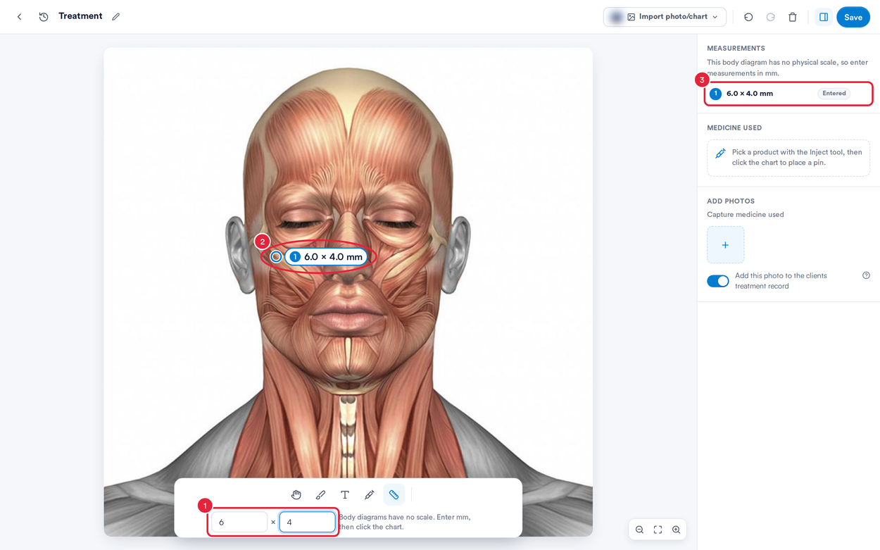 Length and width typed in, a numbered measurement pin on the face diagram and the Entered measurement in the list