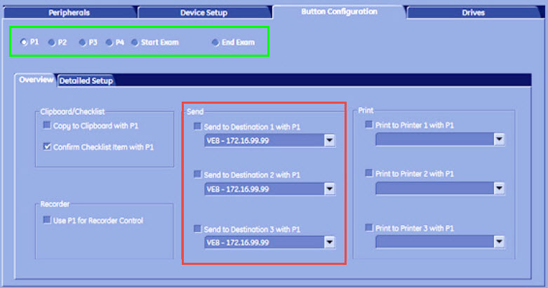 Button Configuration on older models