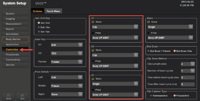 Customize → Buttons: S1 to S3